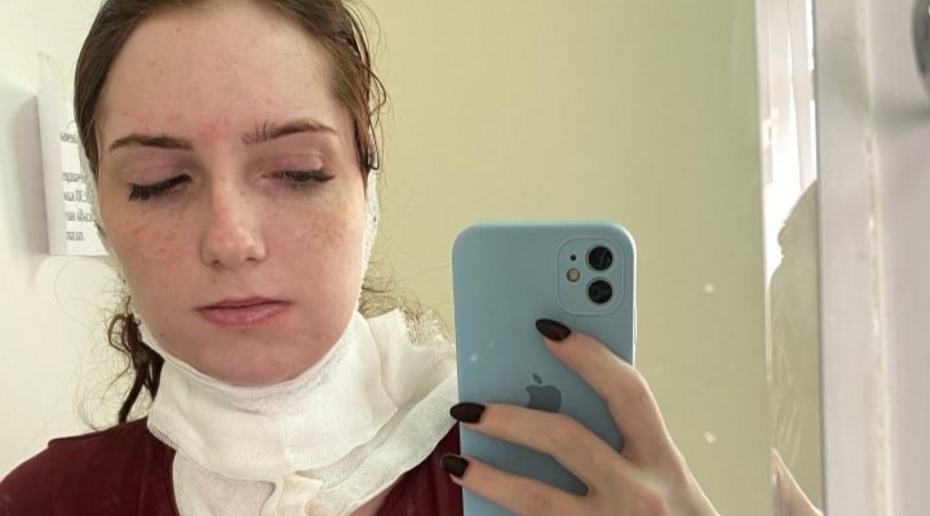 Молодая россиянка удалила зуб мудрости и попала в реанимацию