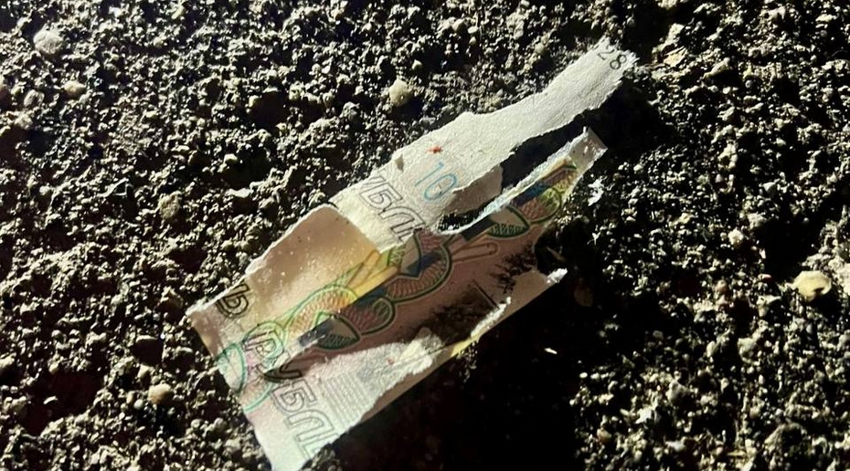 Ребёнок лишился пальцев, подняв купюру с земли в Подмосковье. Что известно