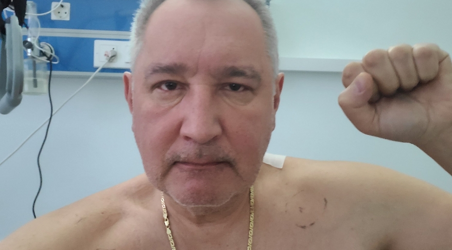 Рогозин выложил первое фото после операции